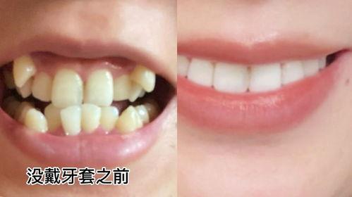 牙齿稀疏的女人吃哈密瓜